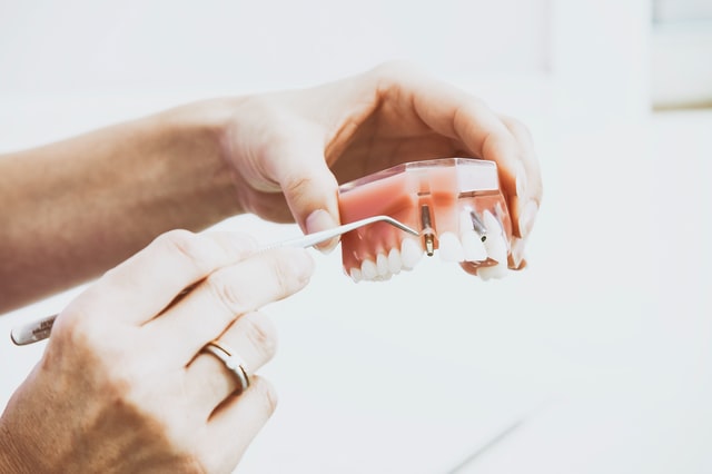 Implant zęba Kraków
